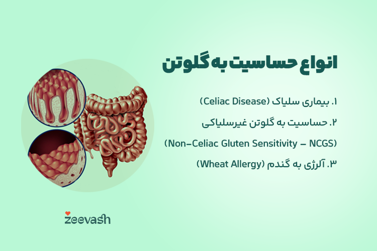 انواع حساسیت به گلوتن